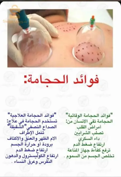 حجامة طبية و التداوي بالطب البديل للنساء فقط