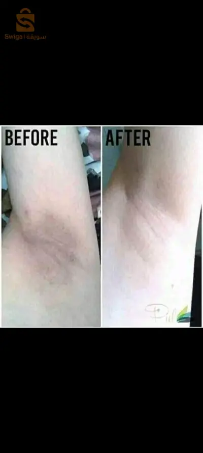 باك للتبيض و النعومة و الترطيب🌹✨️: 

كريم المعجزة créme mini miracle :

🔮ترطيب البشرة🔮🔮مناسبة للرجال و النساء🔮🔮تزيل القشور و التشققات🔮🔮تعمل على تفتيح البشرة  و منحها اشراقة رائعة🔮🔮ذو رائحة رائعة تبقى ملتصقة بالجسم🔮🔮مصممة للوجه و الجسم و يمكن إستخدامها لليدين و الرجلين🔮🔮يزيل اسوداد المناطق المغطاة مثل الإبط و الفخذين و تزيل البقع السوداء و التصبغات🔮

جال المناطق الحميمية gel intime:

✨️يوفر انتعاش✨️✨️يستعمل هذا الجال للنظافة الحميمية (المنطقة الحساسة، الإبطين)✨️✨️يعمل على تبييض و تفتيح المنطقة الحساسة و توحيد لونها✨️✨️ يقضي على مشكلة اسوداد المنطقة نهائيا✨️✨️يعالج الإلتهابات✨️✨️تضييق منطقة المهبل للمتزوجين✨️✨️يعدل درجة حموضة الغشاء✨️✨️ يزيل كل الروائح الغير مرغوب فيها من المنطقة الحساسة و يعطي رائحة تدوم ل 3 ايام✨️✨️له خصائص منعمة و مهدئة✨️

منتجات أصلية و معترفة بها📃✅️

التوصيل متوفر🚚