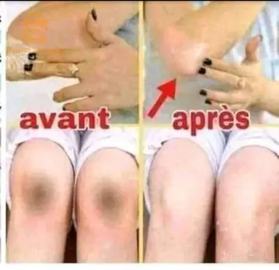 Un package pour blanchir, douceur et fraîcheur🌼🧼