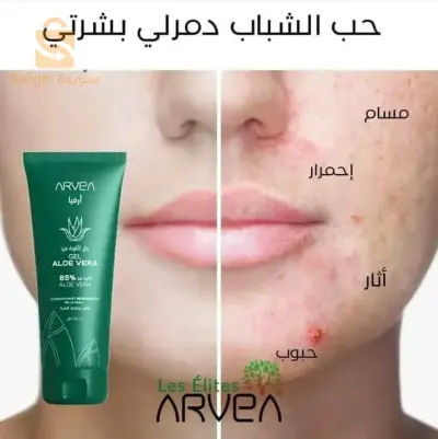 GEL ALOE VERA DE ARVEA ✨️🤩
