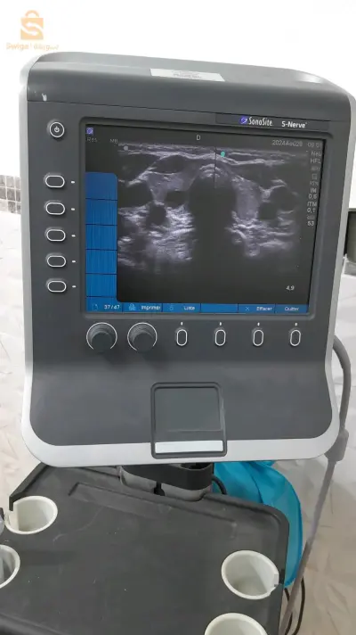 echo dpller