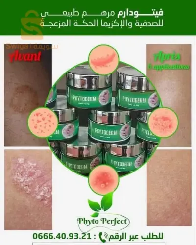 مراهم وخلطات طبيعية